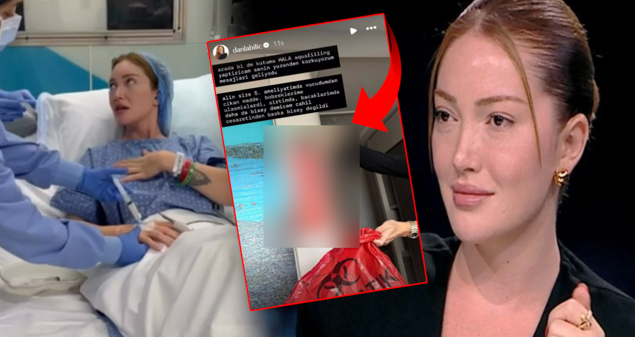 Danla Bilic vücudundan çıkan maddeyi paylaştı: Görenler inanamadı